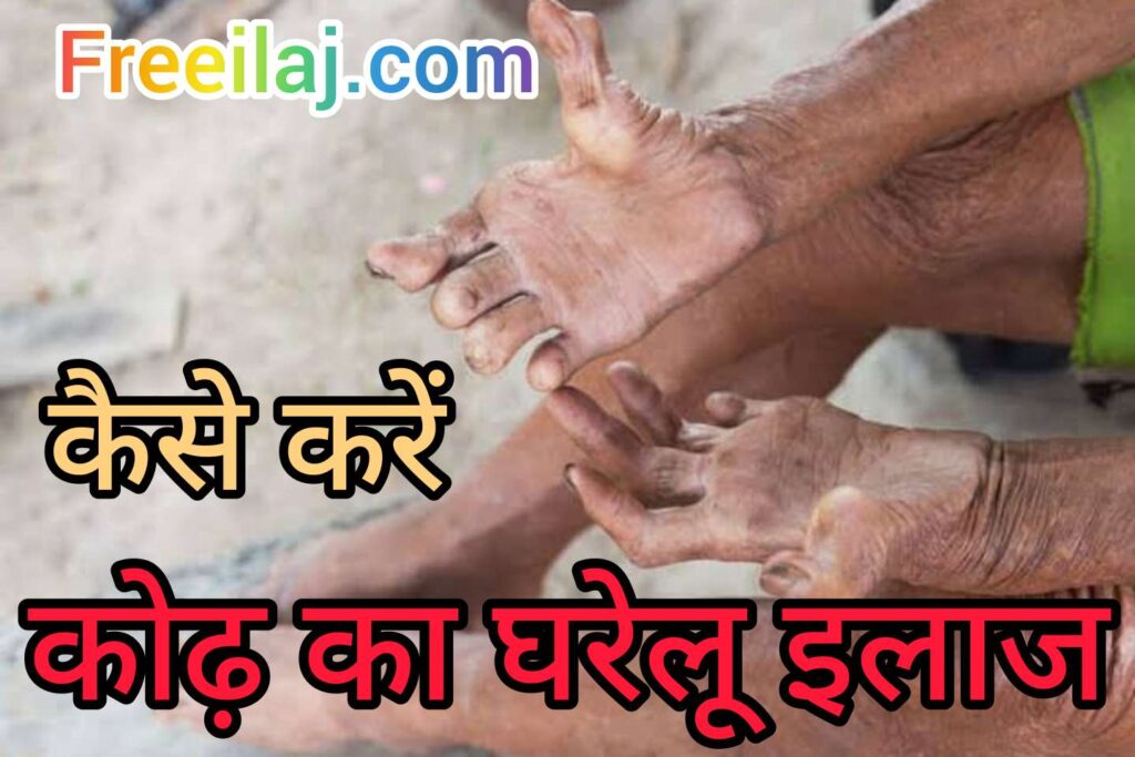 leprosy